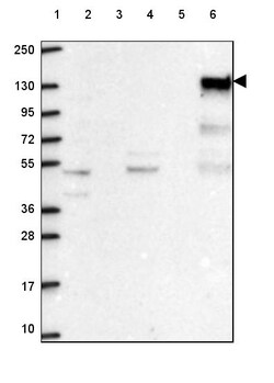 Invitrogen SHIP1 Polyclonal Antibody 100 &mu;L; Unconjugated:Antibodies,
