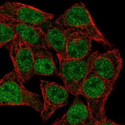 Invitrogen TCF7 Polyclonal Antibody 100 &mu;L; Unconjugated:Antibodies,