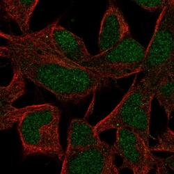 Invitrogen INO80B Polyclonal Antibody 100 &mu;L; Unconjugated:Antibodies,