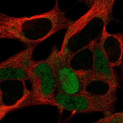 Invitrogen MAGEA10 Polyclonal Antibody 100 &mu;L; Unconjugated:Antibodies,