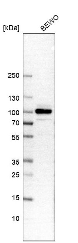 Invitrogen B-Raf Polyclonal Antibody 100 &mu;L | Buy Online | Invitrogen&trade; | Fisher Scientific