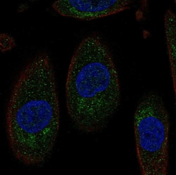 Invitrogen SLC3A1 Polyclonal Antibody 100 &mu;L | Buy Online | Invitrogen&trade; | Fisher Scientific