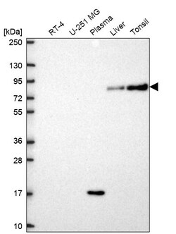 Invitrogen SLC3A1 Polyclonal Antibody 100 &mu;L | Buy Online | Invitrogen&trade; | Fisher Scientific