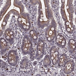 Invitrogen DENND4B Polyclonal Antibody 100 &mu;L; Unconjugated:Antibodies,