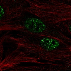 Invitrogen SMURF2 Polyclonal Antibody 100 &mu;L; Unconjugated:Antibodies,