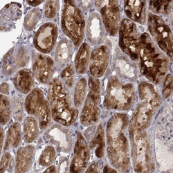 Invitrogen SMURF2 Polyclonal Antibody 100 &mu;L; Unconjugated:Antibodies,