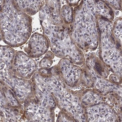 Invitrogen SMURF2 Polyclonal Antibody 100 &mu;L; Unconjugated:Antibodies,