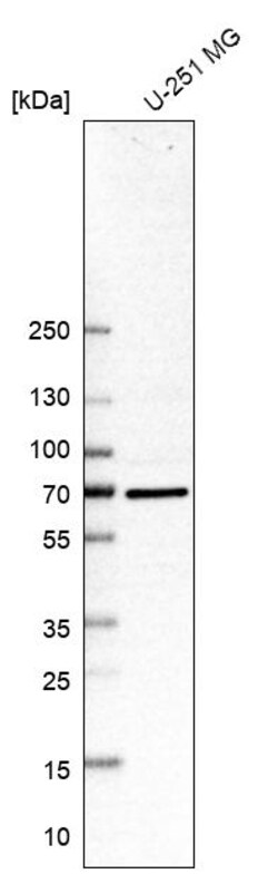 Invitrogen SMURF2 Polyclonal Antibody 100 &mu;L | Buy Online | Invitrogen&trade; | Fisher Scientific