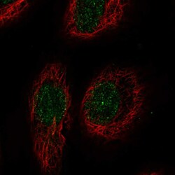 Invitrogen TNFRSF19L Polyclonal Antibody 100 &mu;L; Unconjugated:Antibodies,
