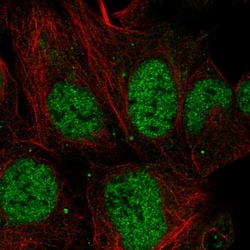 Invitrogen MESDC1 Polyclonal Antibody 100 &mu;L; Unconjugated:Antibodies,