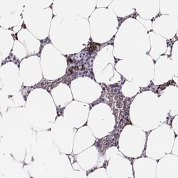 HBZ Polyclonal Antibody:Antibodies, Polyclonal