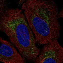Invitrogen TMEM185A Polyclonal Antibody 100 &mu;L; Unconjugated:Antibodies,