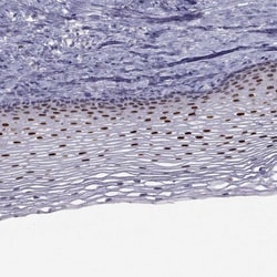 Invitrogen&trade;&nbsp;TRPS1 Polyclonal Antibody