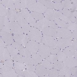 Invitrogen TRPS1 Polyclonal Antibody 100 &mu;L | Buy Online | Invitrogen&trade; | Fisher Scientific