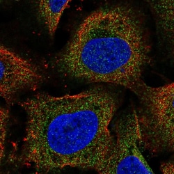 ARHGEF18 Polyclonal Antibody:Antibodies, Polyclonal