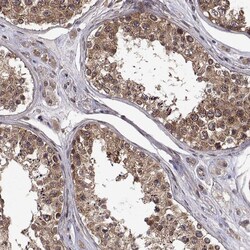 Invitrogen ZNRF2 Polyclonal Antibody 100 &mu;L; Unconjugated:Antibodies,