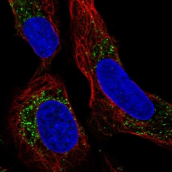 PMEPA1 Polyclonal Antibody:Antibodies, Polyclonal