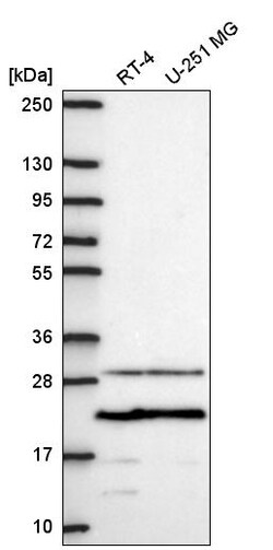 Invitrogen PMEPA1 Polyclonal Antibody 100 &mu;L | Buy Online | Invitrogen&trade; | Fisher Scientific