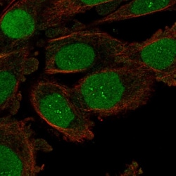 ORC6 Polyclonal Antibody:Antibodies, Polyclonal