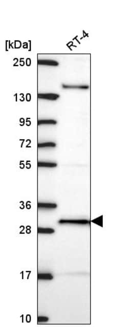 Invitrogen ORC6 Polyclonal Antibody 100 &mu;L | Buy Online | Invitrogen&trade; | Fisher Scientific