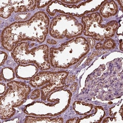 Invitrogen TMEM254 Polyclonal Antibody 100 &mu;L; Unconjugated:Antibodies,