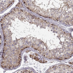 Invitrogen CMTM3 Polyclonal Antibody 100 &mu;L; Unconjugated:Antibodies,