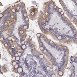 Invitrogen TMPRSS15 Polyclonal Antibody 100 &mu;L; Unconjugated:Antibodies,