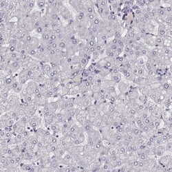 Invitrogen TMPRSS15 Polyclonal Antibody 100 &mu;L; Unconjugated:Antibodies,