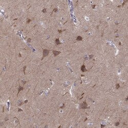 Invitrogen MAST1 Polyclonal Antibody 100 &mu;L | Buy Online | Invitrogen&trade; | Fisher Scientific