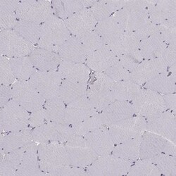 Invitrogen MAST1 Polyclonal Antibody 100 &mu;L | Buy Online | Invitrogen&trade; | Fisher Scientific