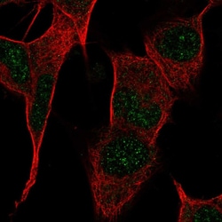 Invitrogen PPP1R17 Polyclonal Antibody 100 &mu;L; Unconjugated:Antibodies,