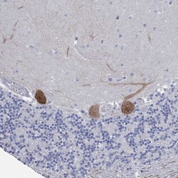 Invitrogen PPP1R17 Polyclonal Antibody 100 &mu;L; Unconjugated:Antibodies,