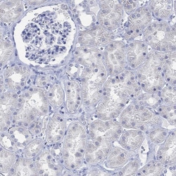 Invitrogen PPP1R17 Polyclonal Antibody 100 &mu;L; Unconjugated:Antibodies,