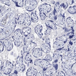 Invitrogen PPP1R17 Polyclonal Antibody 100 &mu;L; Unconjugated:Antibodies,