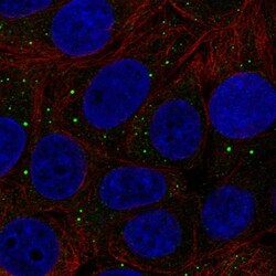 Invitrogen Thrombospondin 3 Polyclonal Antibody 100 &mu;L; Unconjugated:Antibodies,
