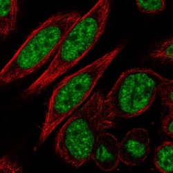 Invitrogen CDK11A Polyclonal Antibody 100 &mu;L; Unconjugated:Antibodies,
