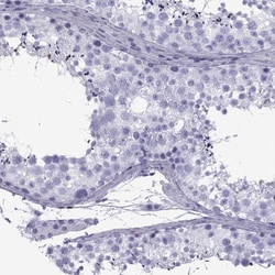 Invitrogen SPANXD Polyclonal Antibody 100 &mu;L; Unconjugated:Antibodies,