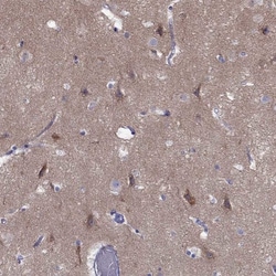 Invitrogen Erc2 Polyclonal Antibody 100 &mu;L; Unconjugated:Antibodies,