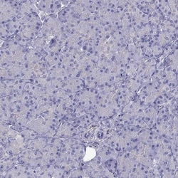 Invitrogen Erc2 Polyclonal Antibody 100 &mu;L; Unconjugated:Antibodies,