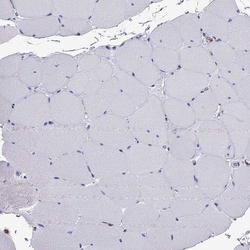 Invitrogen CCL27 Polyclonal Antibody 100 &mu;L; Unconjugated:Antibodies,