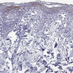 Invitrogen CCL27 Polyclonal Antibody 100 &mu;L; Unconjugated:Antibodies,