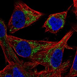 Invitrogen PMPCB Polyclonal Antibody 100 &mu;L; Unconjugated:Antibodies,