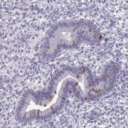 Invitrogen LRRC50 Polyclonal Antibody 100 &mu;L; Unconjugated:Antibodies,