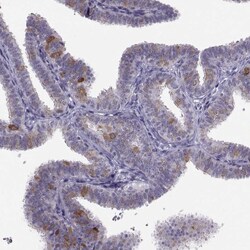 Invitrogen LRRC50 Polyclonal Antibody 100 &mu;L; Unconjugated:Antibodies,