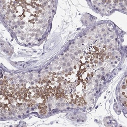 Invitrogen LRRC50 Polyclonal Antibody 100 &mu;L; Unconjugated:Antibodies,