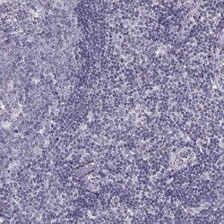 Invitrogen LRRC50 Polyclonal Antibody 100 &mu;L; Unconjugated:Antibodies,