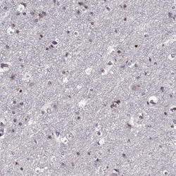 Invitrogen ADAM11 Polyclonal Antibody 100 &mu;L; Unconjugated:Antibodies,