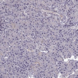 Invitrogen ADAM11 Polyclonal Antibody 100 &mu;L; Unconjugated:Antibodies,