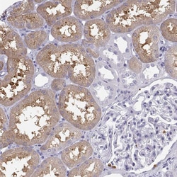 Invitrogen SLC22A6 Polyclonal Antibody 100 &mu;L; Unconjugated:Antibodies,
