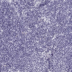 Invitrogen SLC22A6 Polyclonal Antibody 100 &mu;L; Unconjugated:Antibodies,